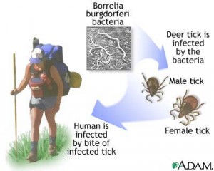 LymeDisease